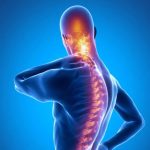تشخیص درد گردن ناشی از اسپوندیلیت آنکیلوزان